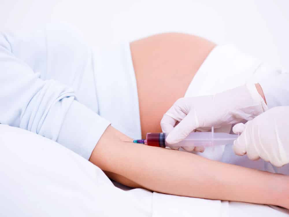 Dépistage prénatal non invasif